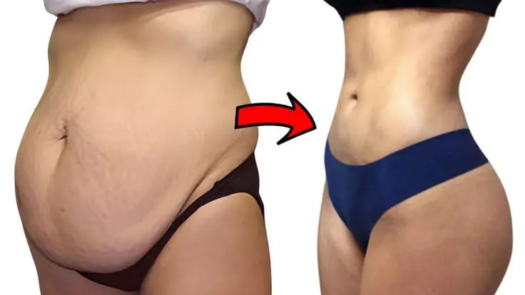 GRACE AESTHETICS PUNE mommy makeover . liposuction , tummy tuck , breast enlarge , breast reduction , vaginoplasty , revirgin, hymenoplasty 